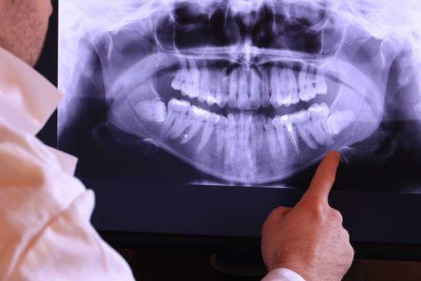 Best Emergency Tooth Extraction in Vista Center, NJ